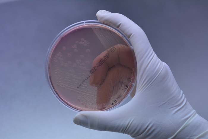  Shigella sonnei bacteria cultivated in a Petri dish (Photo courtesy of the RDA) 