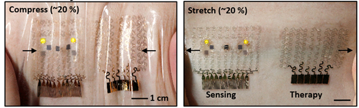 The newly developed device is highly elastic, as it's made from graphene components. Even if the skin moves around after having the device attached, it can still control blood sugar levels.