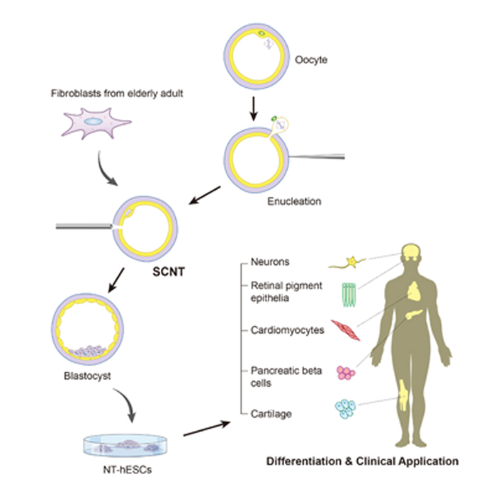  The process of producing and using somatic cell nuclear transfer (SCNT) methods to create embryonic stem cells for therapeutic purposes. (image courtesy of the CHA General Hospital Group) 