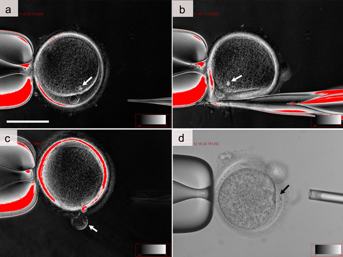  The steps involved during a somatic cell nuclear transfer (SCNT). (a) A human ovum. (b) The pellucid zone, located below an area containing the genetic material of the ovum, is incised using a knife pipette. The arrow points to the genetic material to be enucleated. (C) A cytoplasm containing genetic material from the ovum is eliminated using a knife pipette. (d) The nucleus of an adult male is inserted into an enucleated ovum. (images courtesy of the CHA General Hospital Group) 