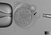 Embryonic stem cells cloned for first time using adult cells