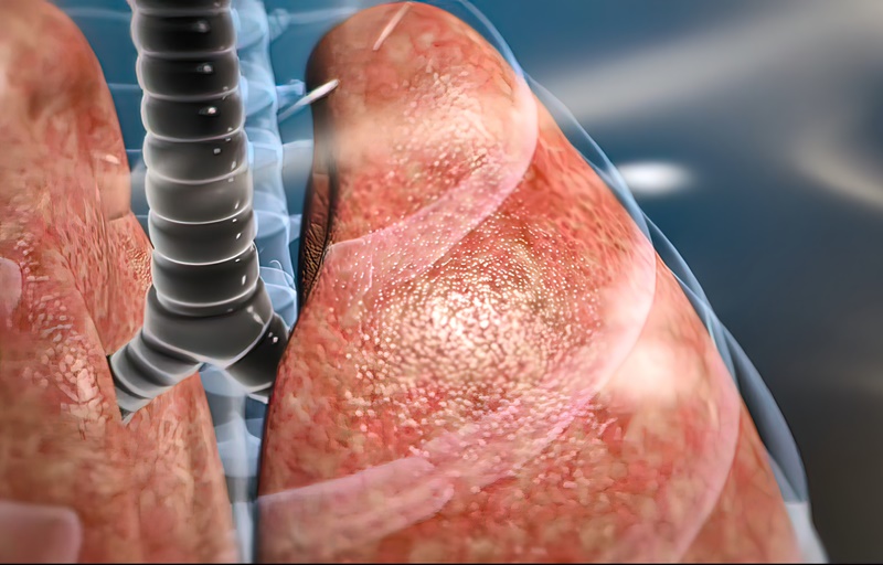 ▲A joint research team led by Sungkyunkwan University professor Park Woo-ram and University of Hawaii professor Saguna Verma has developed a next-generation lipid nanoparticle method to effectively suppress inflammation and tissue damage in lungs caused by COVID-19. (iClickArt) *Unauthorized reproduction and redistribution of this photo is prohibited under copyright law.