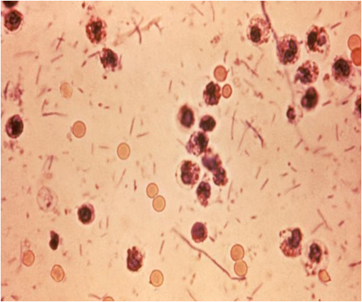  A magnified view of Shigella sonnei as seen through a microscope (Photo courtesy of the RDA) 