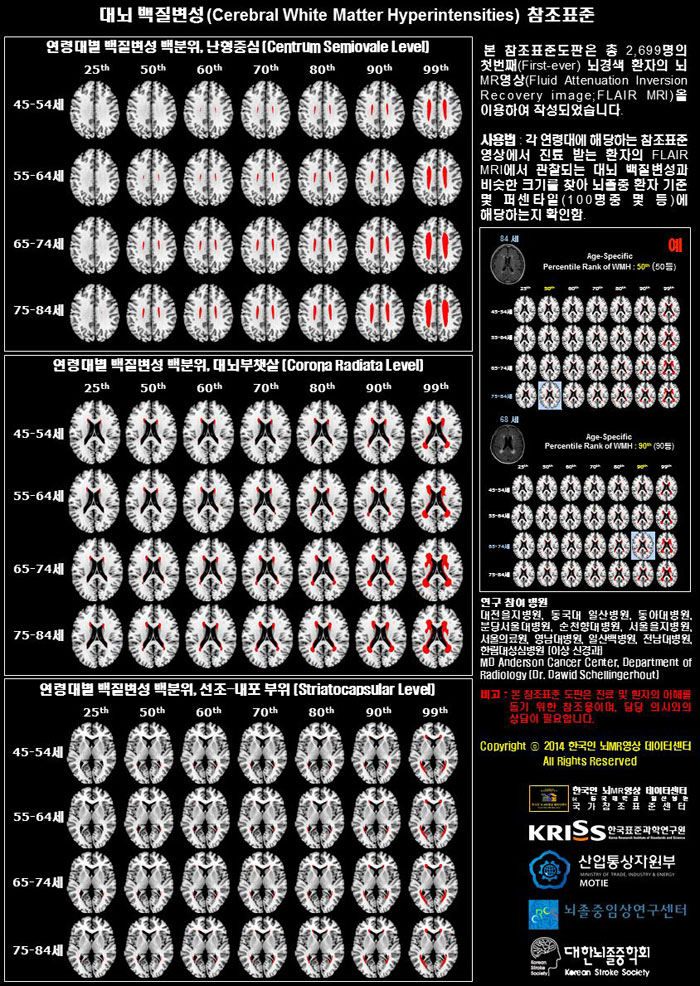 The KRISS and 11 participating university hospitals created a 'brain map of ischemic stroke' by making a standard medical chart based on the accumulated data collected from their patients. People can compare MRI images with the brain map.