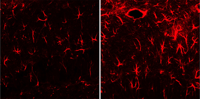 The photograph of a hippocampus, the area of the brain responsible for memory, shows that the neurogliocytes are very active in the brain of a normal mouse (left) and in that of a taurine-fed mouse with Alzheimer's disease. 