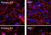 One step closer to curing heart disease, researchers create blood vessels