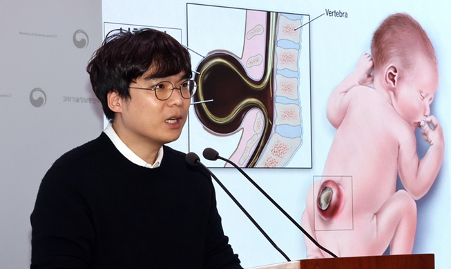 Causes of birth defect affecting spine, spinal cord found