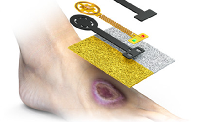 'Smart dressing patch' lowers risk of diabetic foot amputation